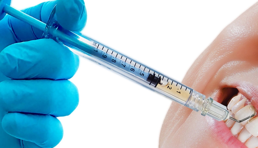 Adjuvantien in der PAR Therapie